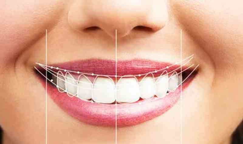 Curso estética dental