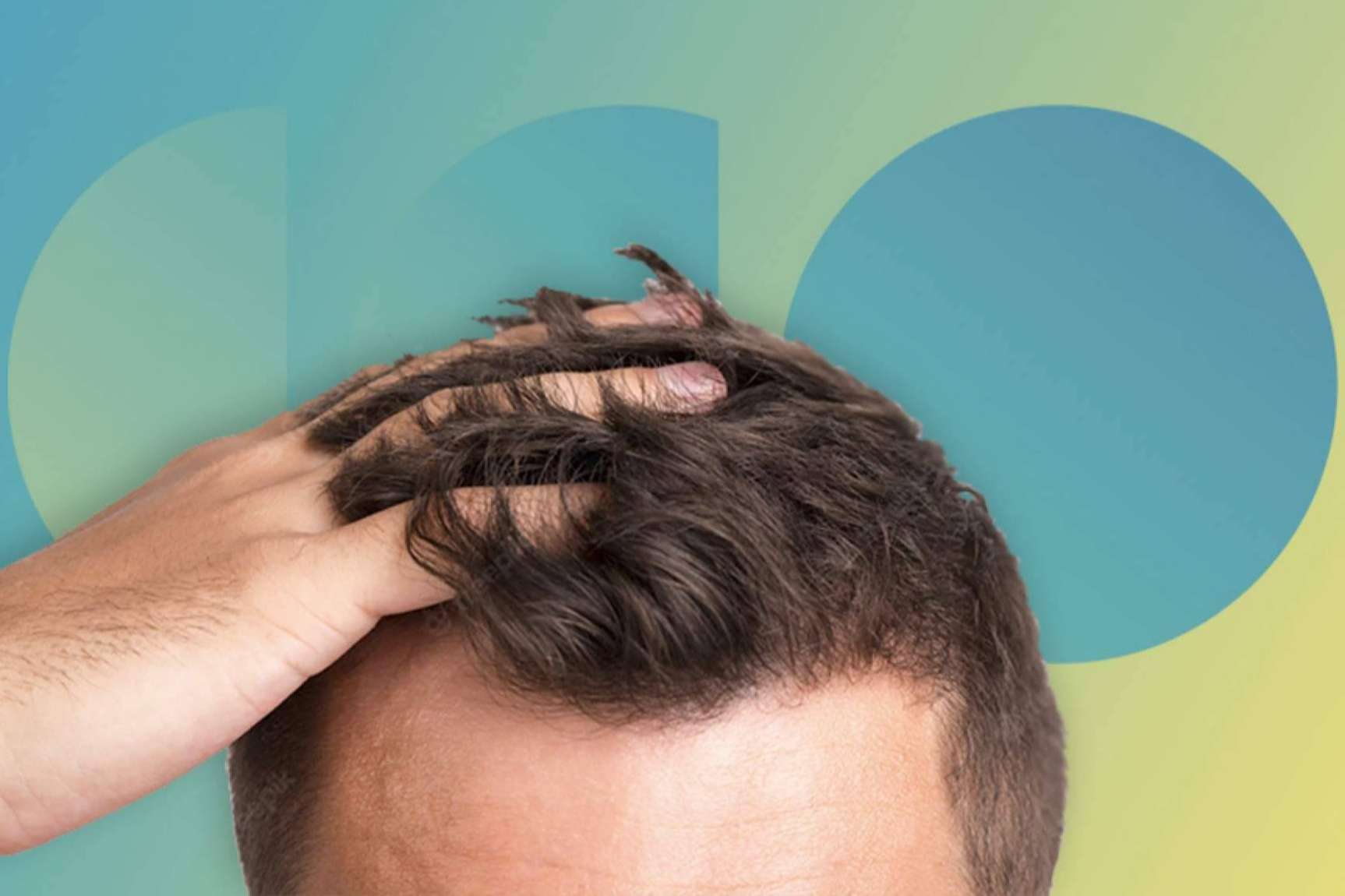Este año la caída de cabello estacional viene más fuerte